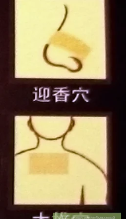 TIBEANTIRENIT (Тибеантиренит) – Лейкопластыри для лечения ренитов и храпа - фото № 3