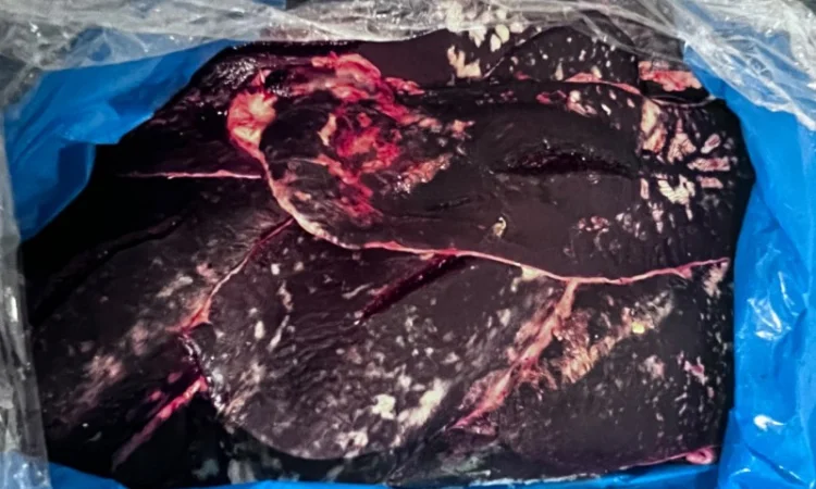 Селезінка - фото № 1