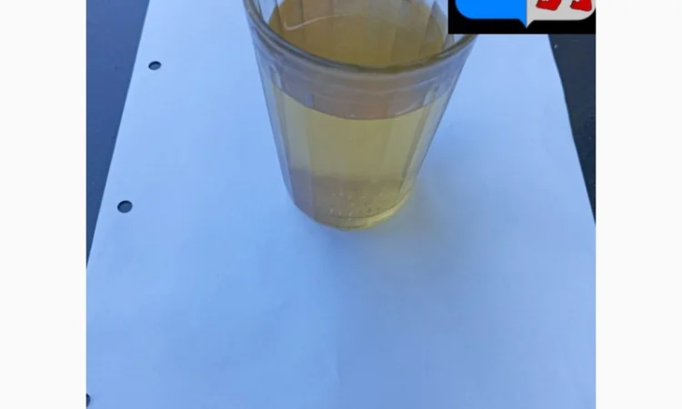 Уксус для волос: натуральное решение против перхоти и не только - фото № 20