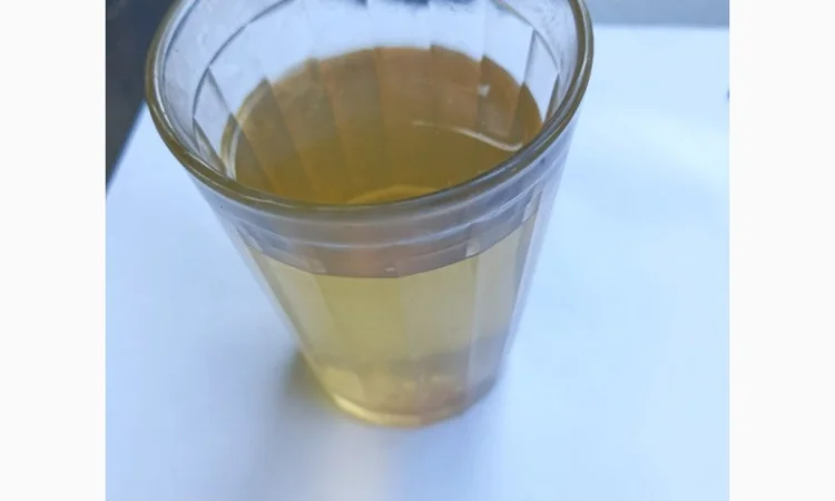 Яблочный уксус с утра: заряд здоровья и энергии - фото № 19