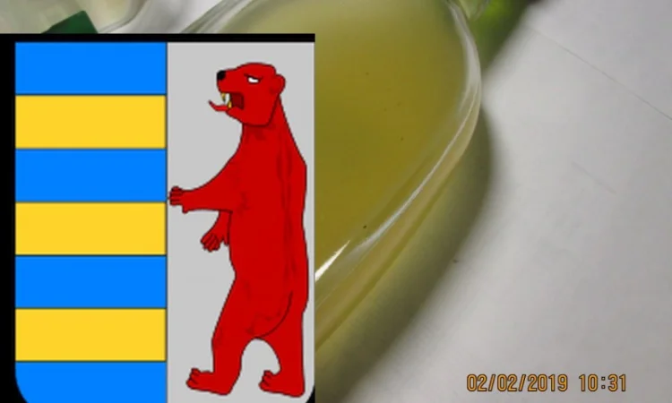 Яблочный уксус для волос: тайна здоровья и красоты - фото № 16