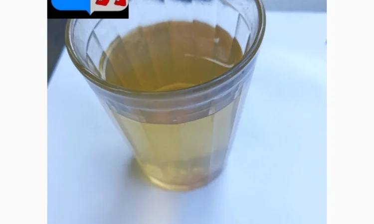 Косметика для локонов из уксуса: секреты здоровых волос - фото № 17