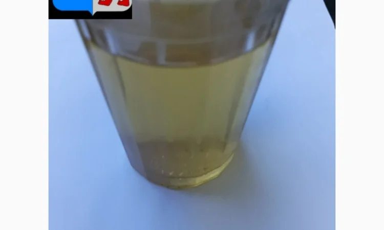 Яблочный уксус для здоровых и красивых волос - фото № 19