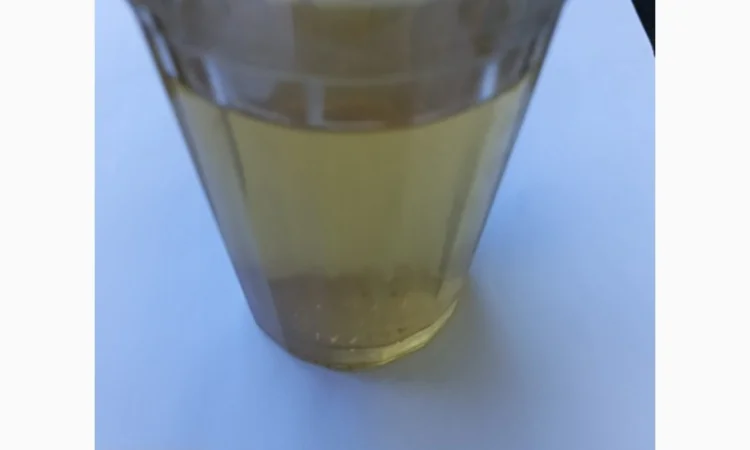 Яблочный уксус и кашель: полезная информация - фото № 18