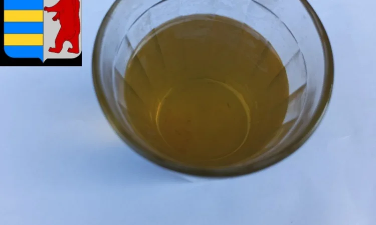 Яблочный уксус и кожа: что говорят исследования - фото № 2