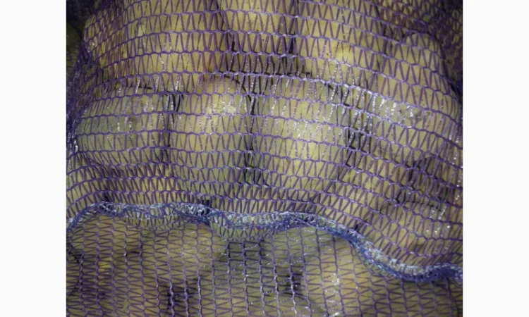 Продаж товарної картоплі білого сорту від 20 тонн оптом - фото № 1