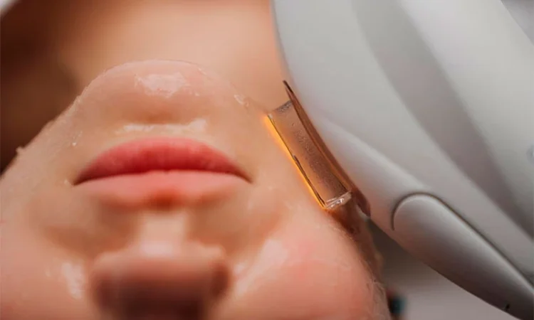 Качественный СМАС-лифтинг в Киеве - Са-Ната Эстетик - фото № 1