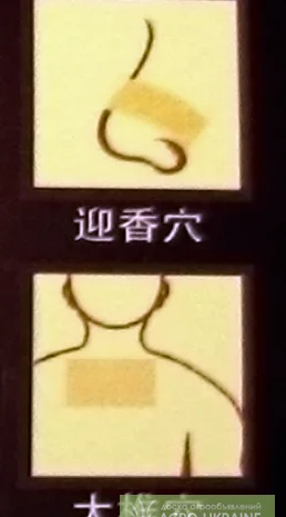 TIBEANTIRENIT (Тибеантиренит) – Лейкопластыри для лечения ренитов и храпа- фото № 3