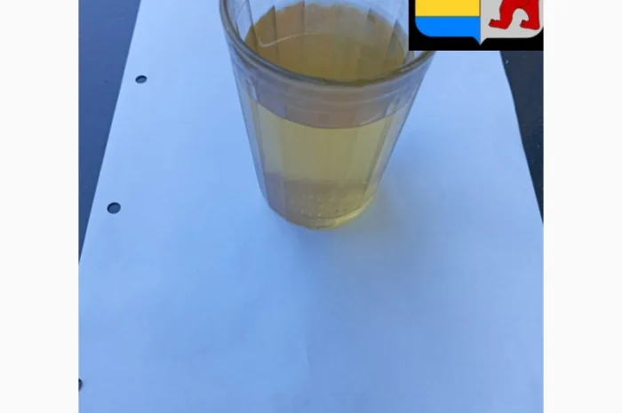 Уксус для волос: натуральное решение против перхоти и не только- фото № 20