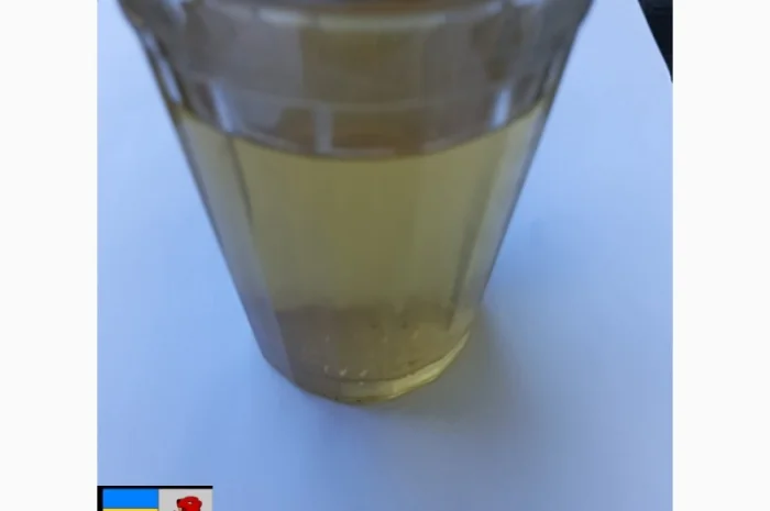 Яблочный уксус и кашель: полезная информация- фото № 18