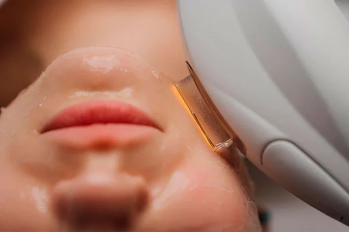 Качественный СМАС-лифтинг в Киеве - Са-Ната Эстетик- фото № 1