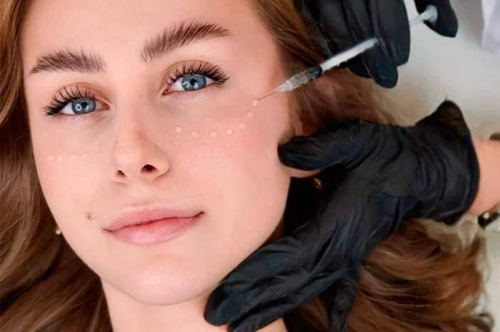 Професійна біоревіталізація - Rejuran- фото № 1