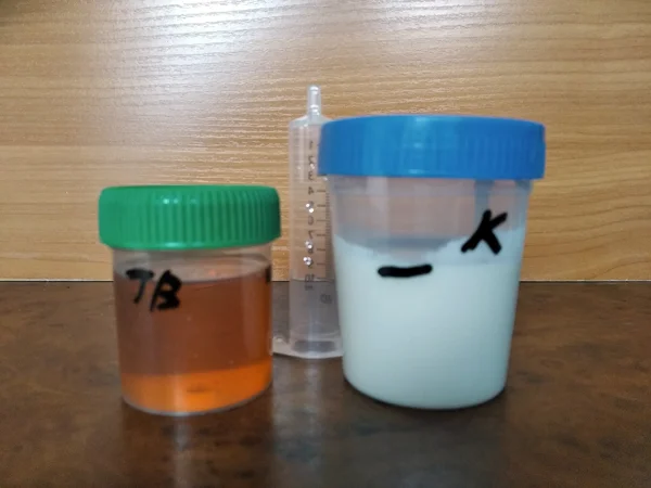 Клей для пластиковых накладок Zedex ( Wolf, ФРГ) - фото № 3